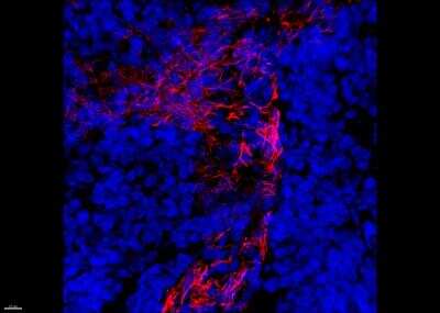 alpha-Smooth Muscle Actin Antibody (1A4/asm-1) [Janelia Fluor® 549 ...